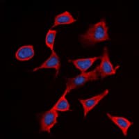 IL2RB / CD122 Antibody (phospho-Tyr364)