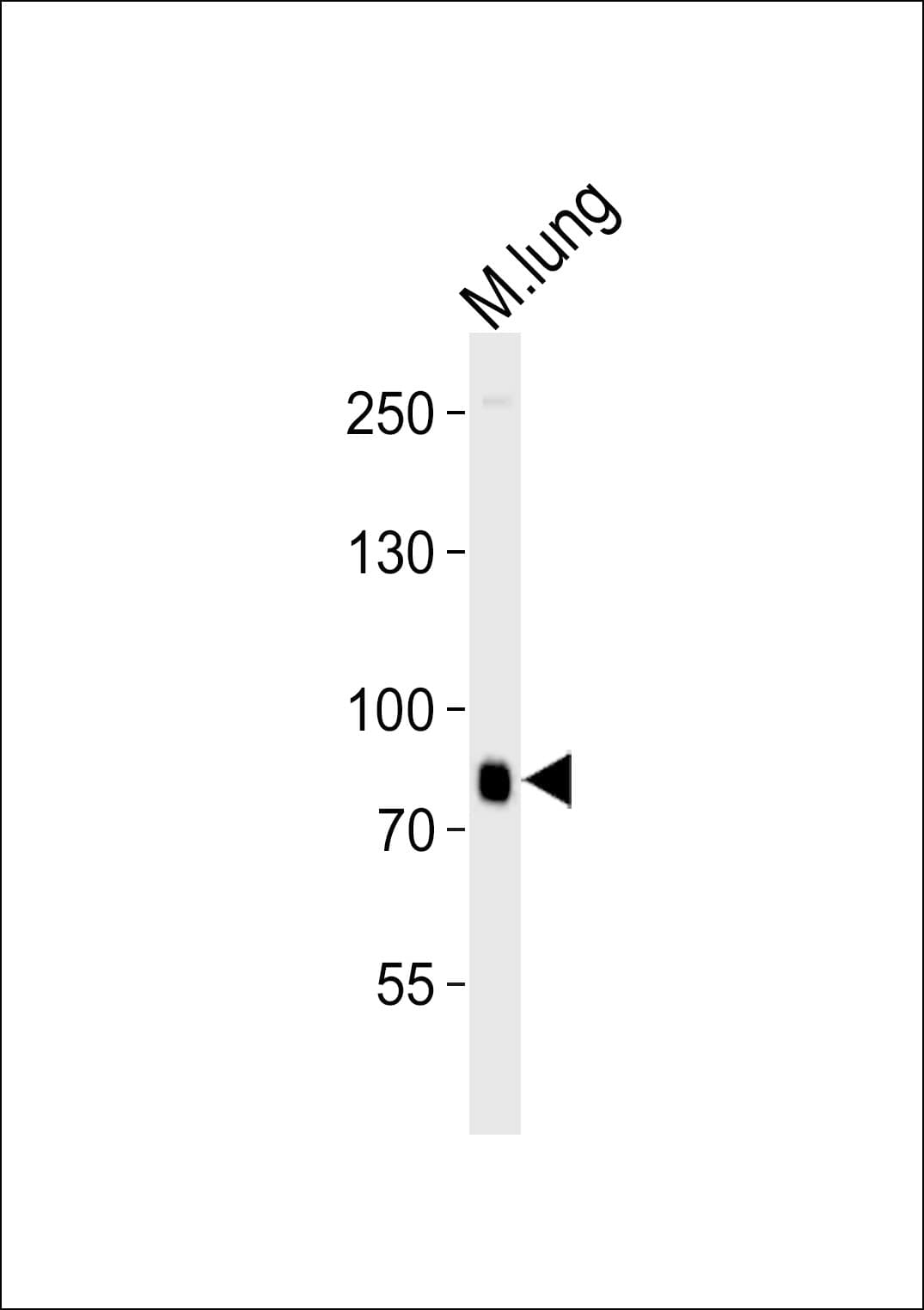 BRD7 Antibody (aa387-418)
