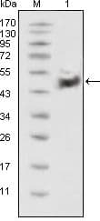Tumor suppressor p53 Antibody (clone 4A8)