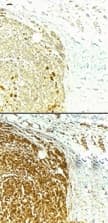 BIRC5 / Survivin Antibody