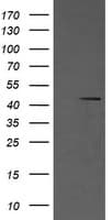 Monoclonal Mouse anti-Human MAP2K1 / MKK1 / MEK1 Antibody (clone OTI3E6, IHC, IF, WB)