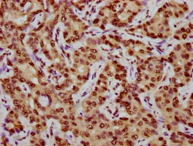 Polyclonal Rabbit anti-Human CENPA / CENP-A Antibody (IHC)