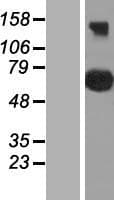 CEP76 Protein (Over-Expression Lysate Myc-DDK (Flag))