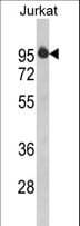 HTATSF1 / TAT-SF1 Antibody (aa1-30)