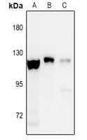EPHA8 / EPH Receptor A8 Antibody