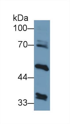 GPT2 / ALT2 Antibody (aa210-300, PE)