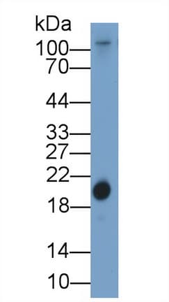 RBP4 Antibody (aa22-196)