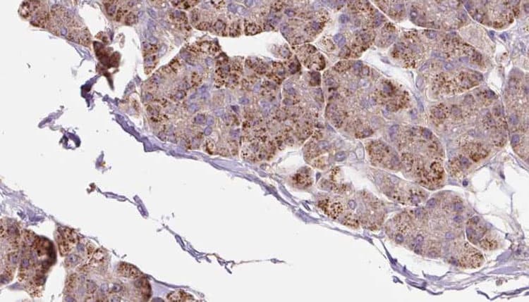 PACS2 Antibody