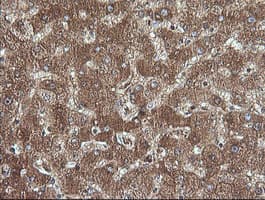 CTAG1B / NY-ESO-1 Antibody (clone OTI4B11, Carrier-free)
