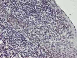 SNAI2 / SLUG Antibody (clone OTI2B11)