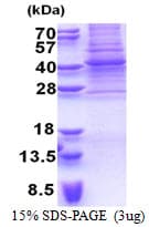 Human PAX9 Protein (Recombinant His)