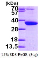 Human PYCR1 Protein (Recombinant His)