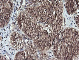 Monoclonal Mouse anti-Human ANAPC11 / APC11 Antibody (clone OTI1F2, IHC, WB)