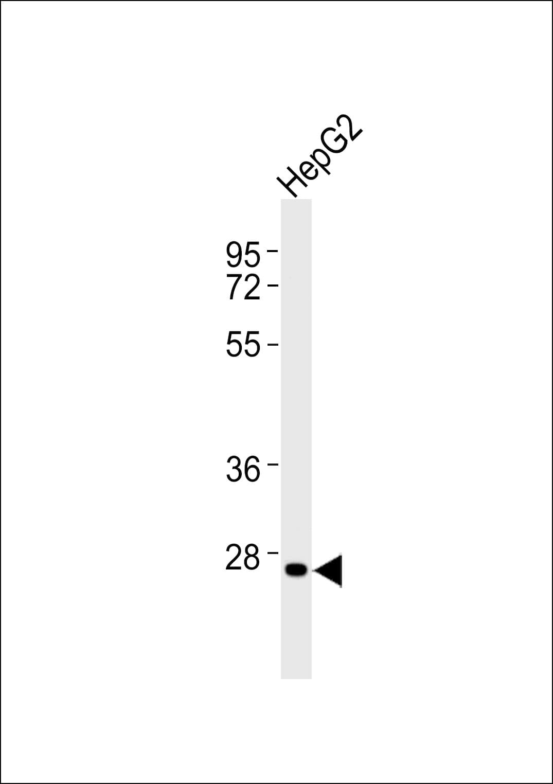 Polyclonal Rabbit anti-Human HOXC12 Antibody (WB)