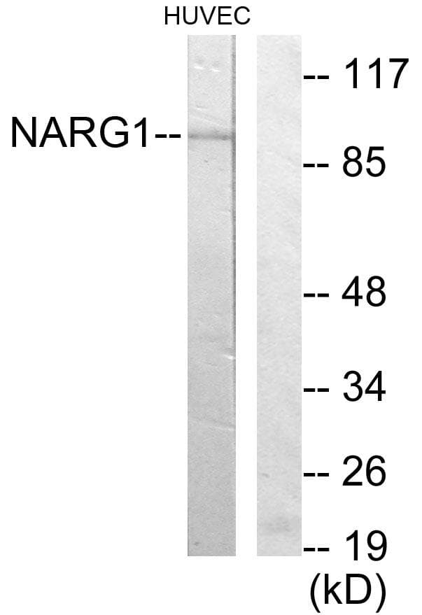Polyclonal Rabbit anti-Human NARG1 / NAA15 Antibody (WB)