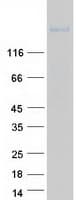 Human ROBO2 Protein (Recombinant Myc-DDK (Flag))