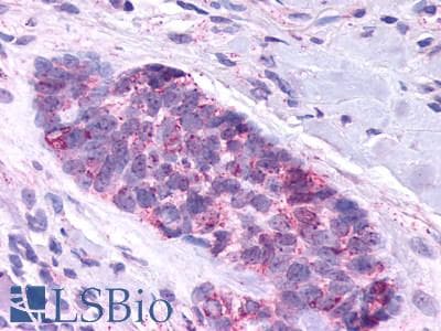 IHC-plus™ Polyclonal Rabbit anti-Human SMO / Smoothened Antibody (1st Extracellular Domain, IHC, IF)