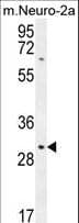 TMEM65 Antibody (aa33-61)