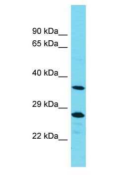 PTPN20 Antibody (aa69-118)