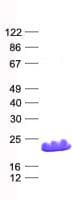 Human EIF1AY Protein (Recombinant His, N-Terminal)