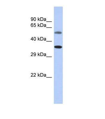 CDK7 Antibody (N-Terminus)