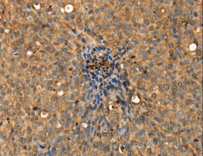 Polyclonal Rabbit anti-Human ADCY3 / Adenylate Cyclase 3 Antibody (IHC)