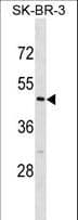 CASQ2 / Calsequestrin 2 Antibody (aa79-107)