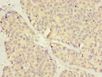 LRRC8E Antibody (aa353-630)