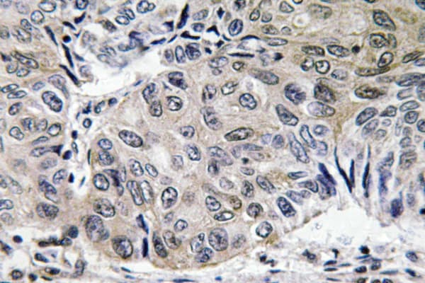 S100A10 Antibody (Val52)