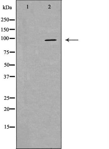 Polyclonal Rabbit anti-Human HIWI2 / PIWIL4 Antibody (WB)
