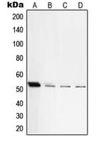 Polyclonal Rabbit anti-Human PRKACB Antibody (C-Terminus, IHC, WB)