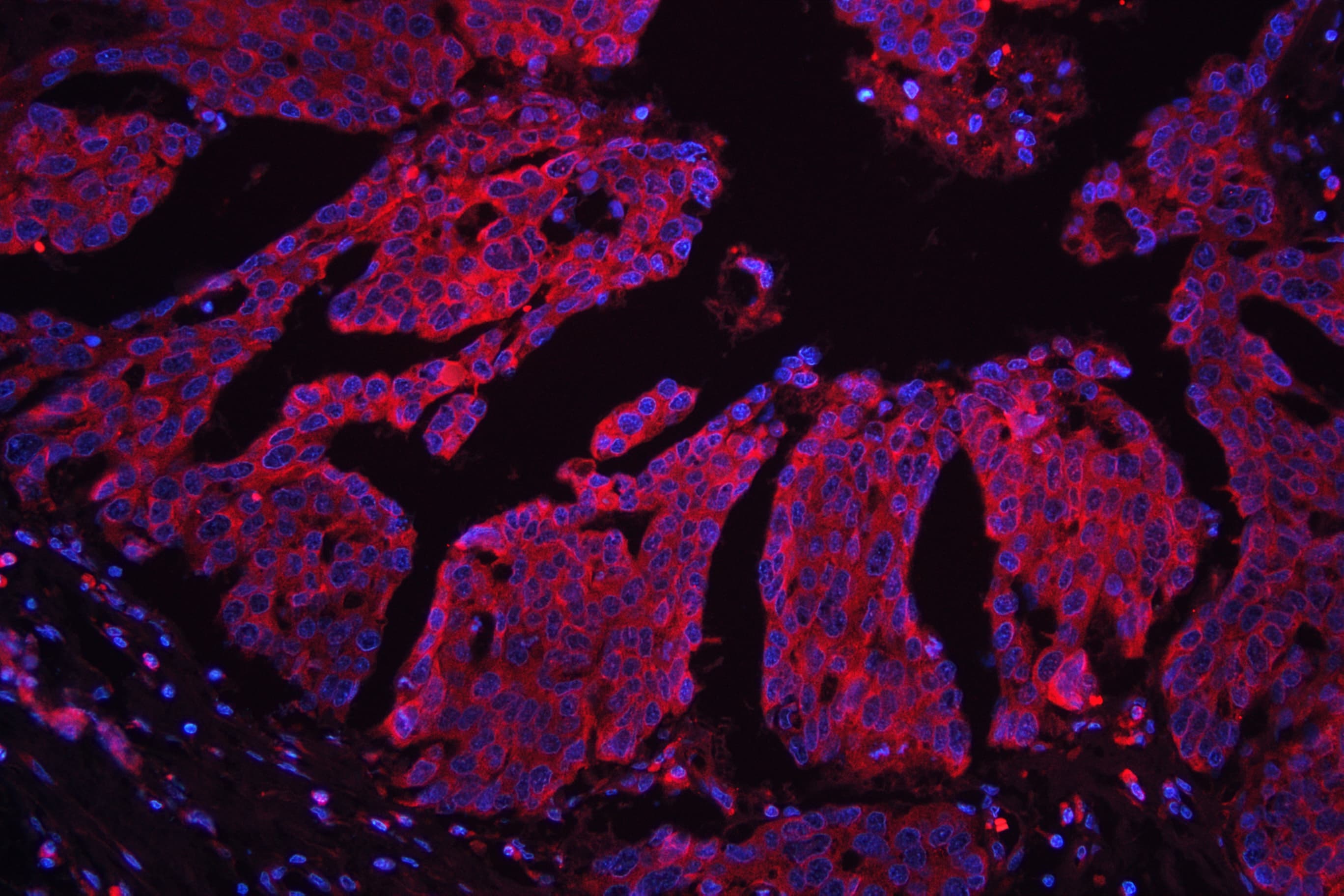 Polyclonal Rabbit anti-Human RPS27 / Ribosomal Protein S27 Antibody (IHC, WB)