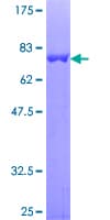 Human CHN1 Protein (Recombinant GST)