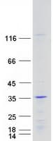 Human HOXC6 Protein (Recombinant Myc-DDK (Flag))