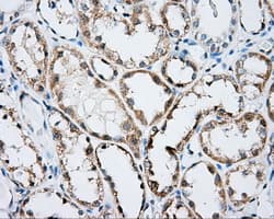 ARHGDIA / RHOGDI Antibody (clone OTI1A7)