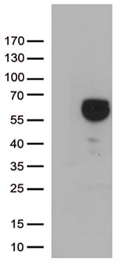 P5CDH / ALDH4A1 Antibody (aa1-503, clone OTI1H10)