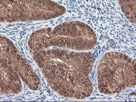 Monoclonal Mouse anti-Human LCMT1 Antibody (clone OTI2C9, IHC, WB)
