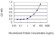 Monoclonal Mouse anti-Human TSTA3 / GDP-L-Fucose Synthase Antibody (clone 2B9, WB)