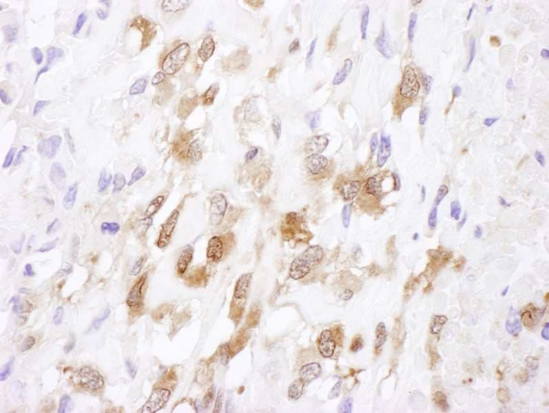 SOD1 / Cu-Zn SOD Antibody (aa104-154)