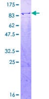 Human NR2C2 / TAK1 Protein (Recombinant GST)