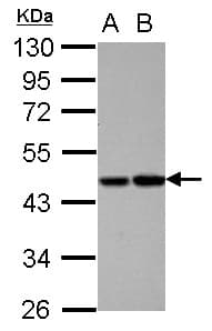 PROC / Protein C Antibody