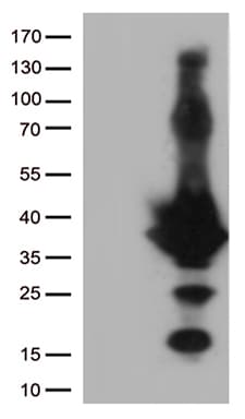 EFHD1 Antibody (clone OTI8D9)