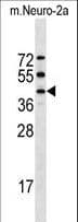 Polyclonal Rabbit anti-Mouse STK32A Antibody (aa347-374, WB)