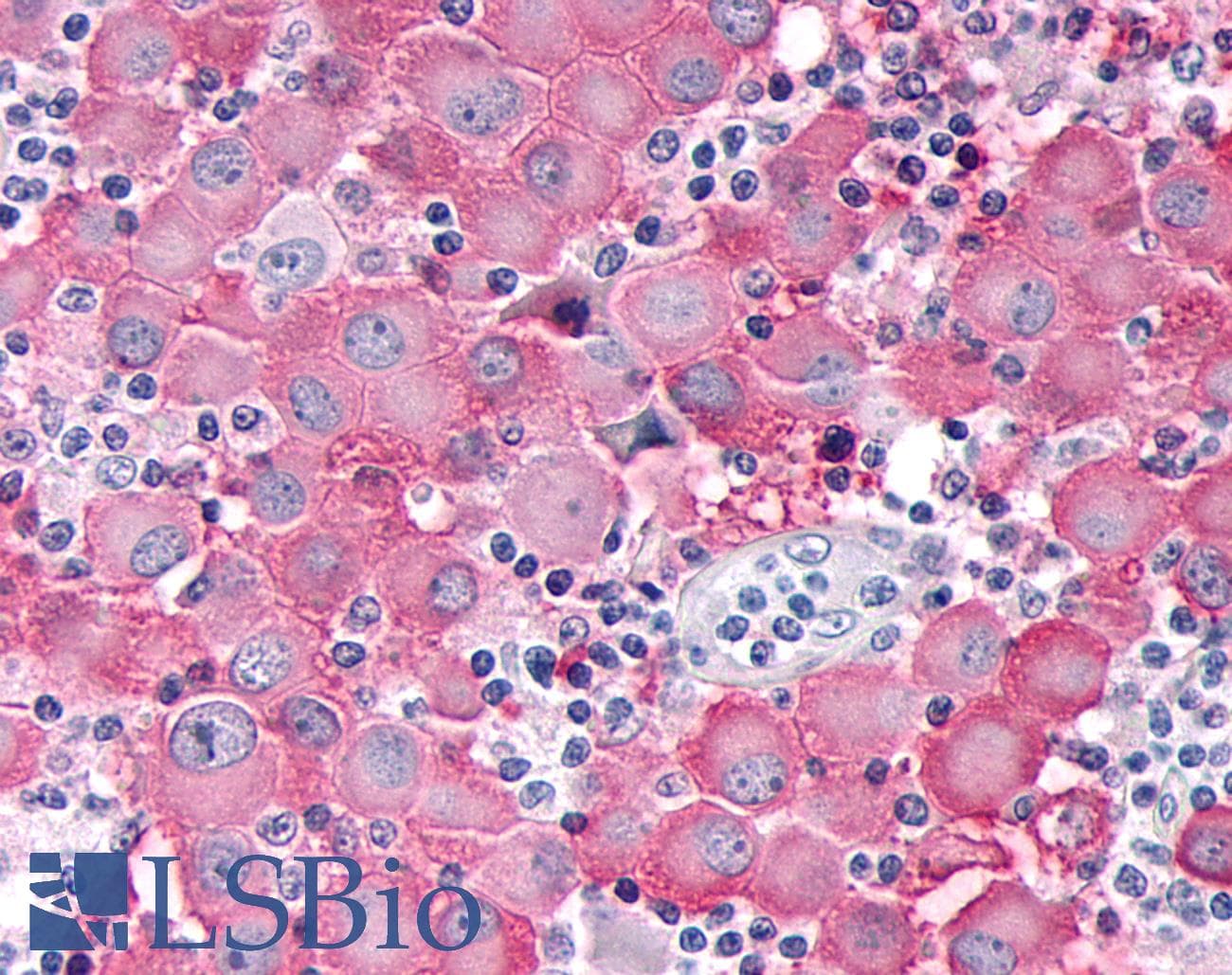 PathPlus™ Polyclonal Rabbit anti-Human ADAMTS4 Antibody (Disintegrin-like Domain, IHC)