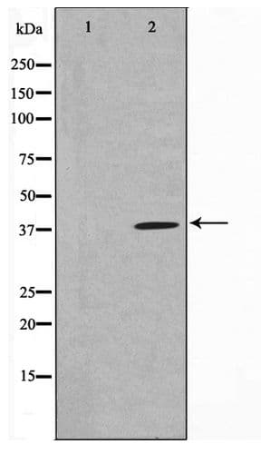 MOS Antibody