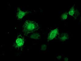 KIAA0153 / TTLL12 Antibody (clone OTI3H6)