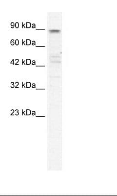 KCNQ2 Antibody (aa154-203)