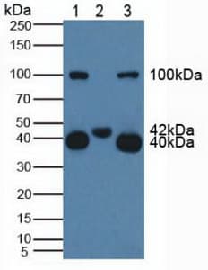 KLRB1 / CD161 Antibody (aa73-188, Biotin)