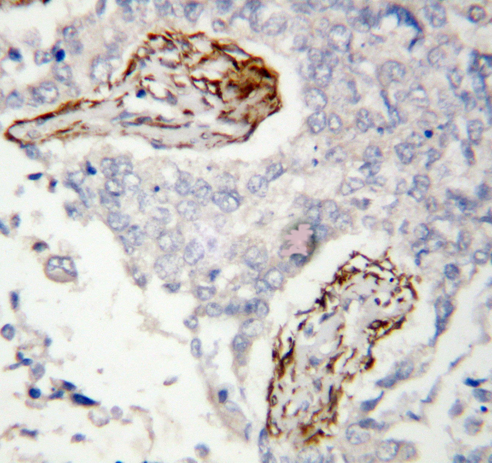 HDAC8 Antibody (aa18-33)