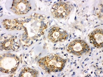 Polyclonal Rabbit anti-Human B3GNT8 Antibody (IHC, WB)